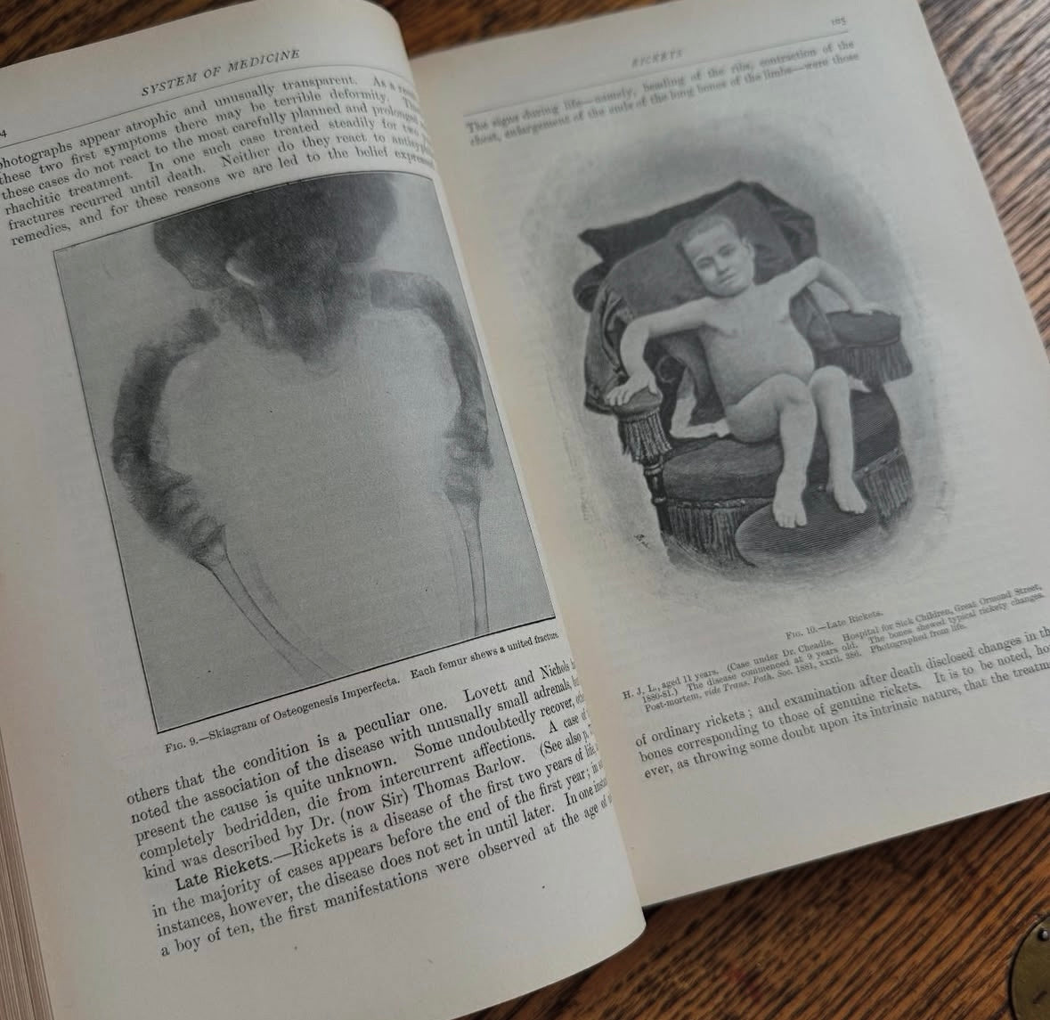 A System of Medicine in 11 Volumes, 1911