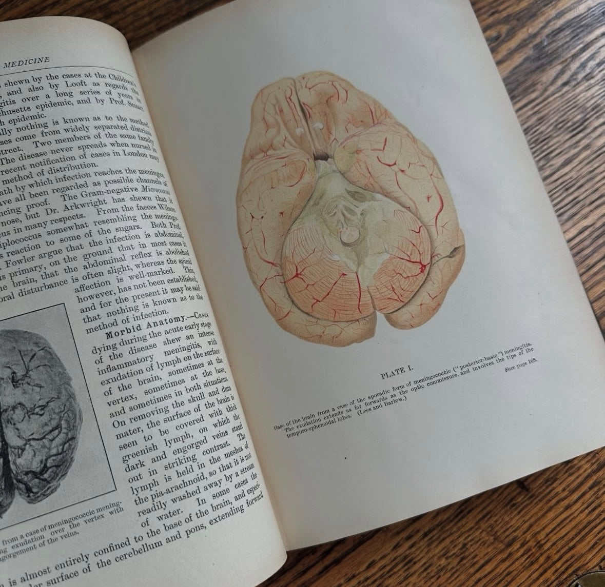 A System of Medicine in 11 Volumes, 1911