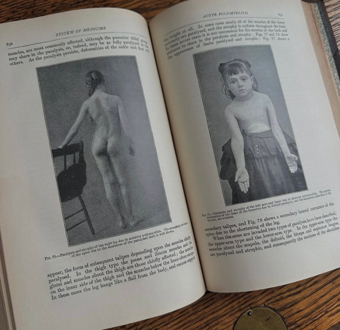 A System of Medicine in 11 Volumes, 1911