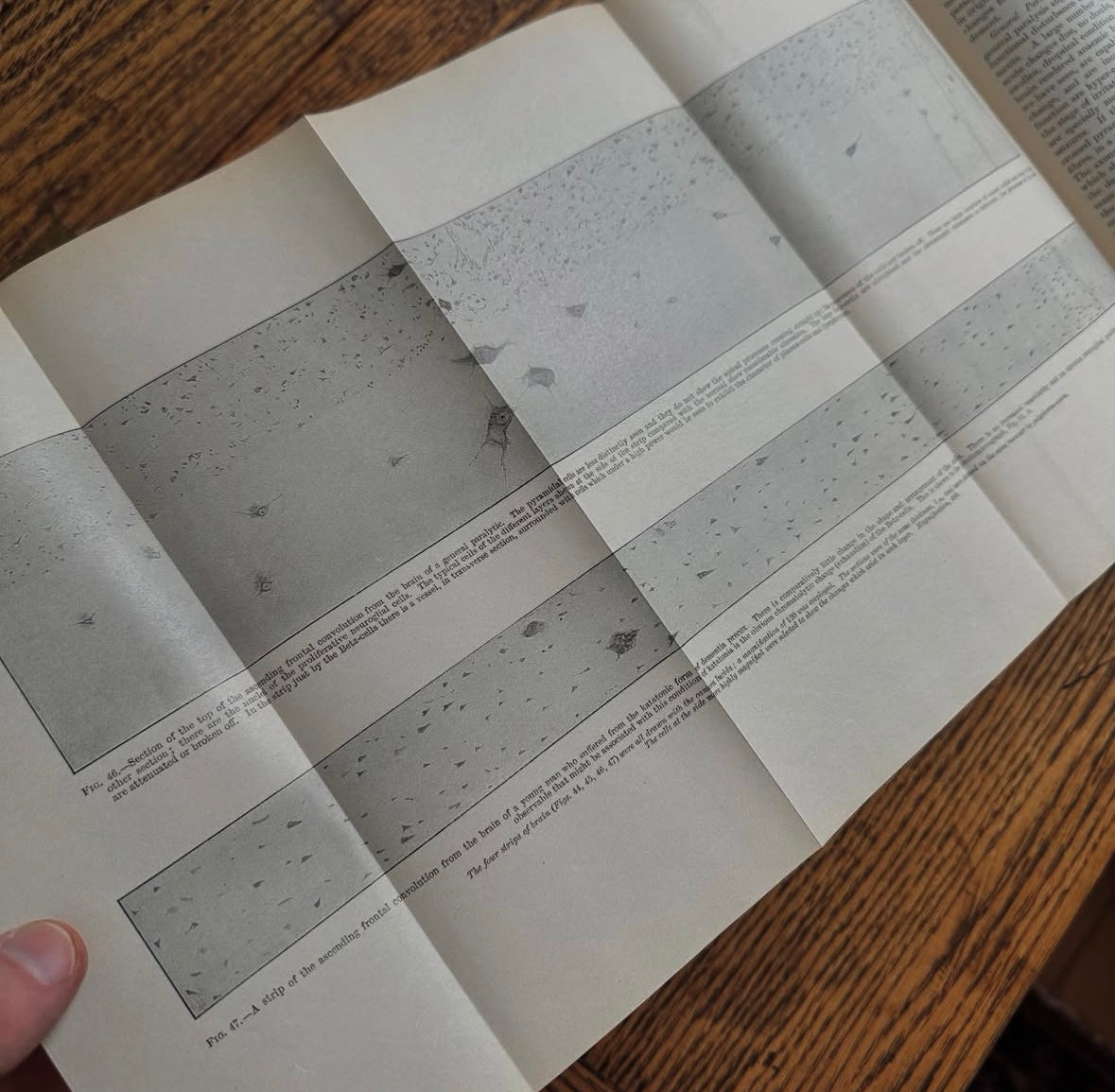 A System of Medicine in 11 Volumes, 1911