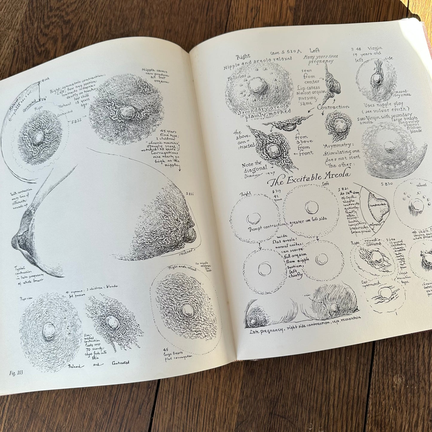 Human Sex Anatomy: A Topographical Hand Atlas, 1949
