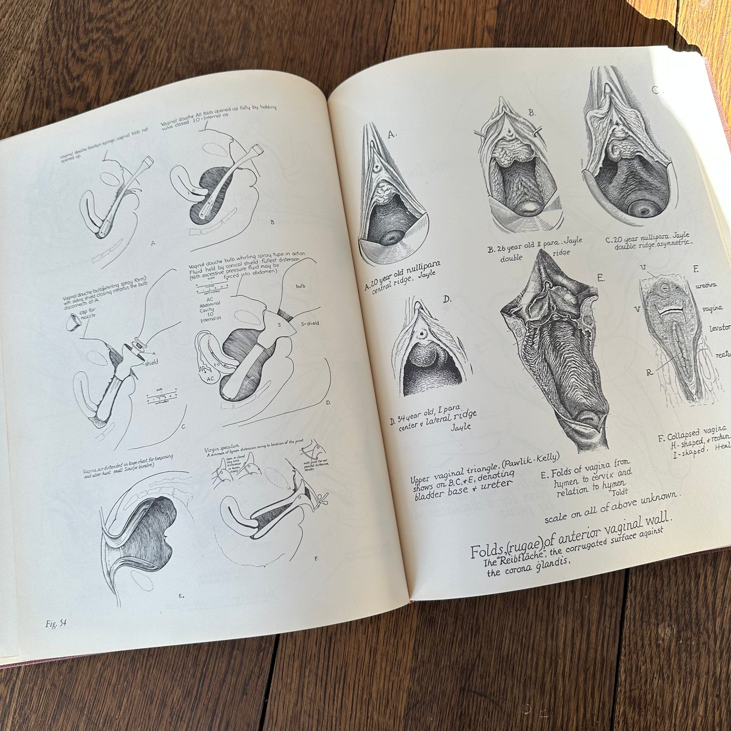Human Sex Anatomy: A Topographical Hand Atlas, 1949