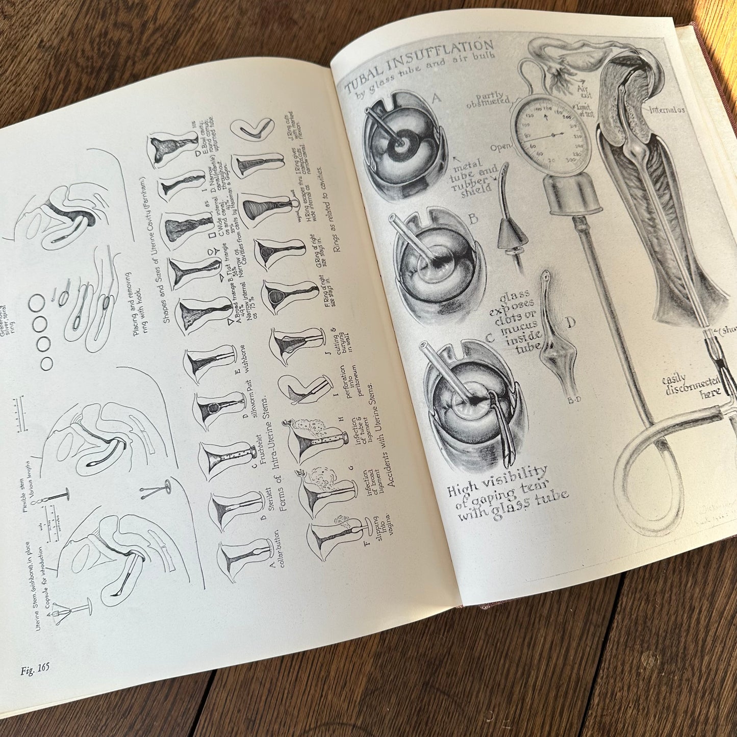 Human Sex Anatomy: A Topographical Hand Atlas, 1949