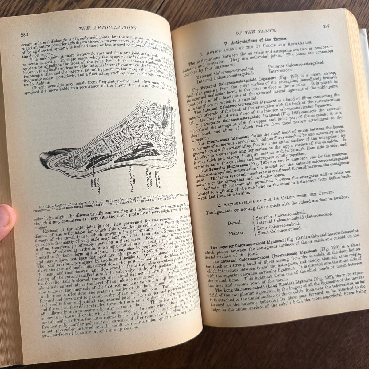 Gray’s Anatomy, 1977 Classic Collector’s Edition — Henry Gray, Descriptive & Surgical Anatomy | Bounty Books Hardcover, 780 Illustrations
