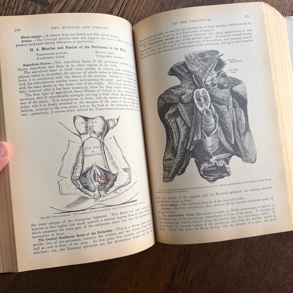 Gray’s Anatomy, 1977 Classic Collector’s Edition — Henry Gray, Descriptive & Surgical Anatomy | Bounty Books Hardcover, 780 Illustrations