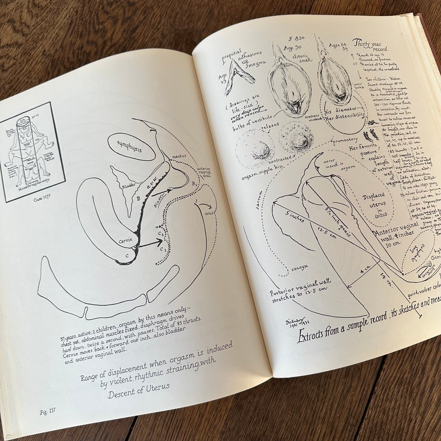 Human Sex Anatomy: A Topographical Hand Atlas, 1949