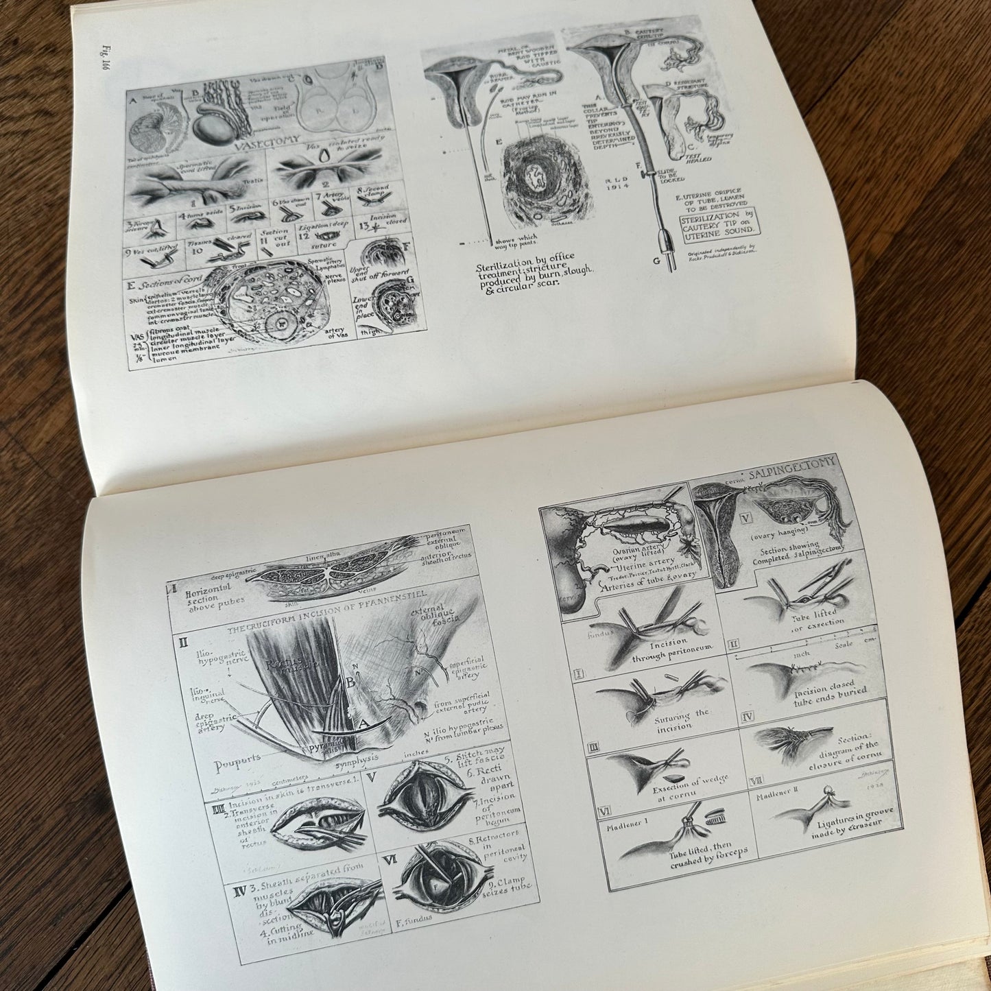 Human Sex Anatomy: A Topographical Hand Atlas, 1949