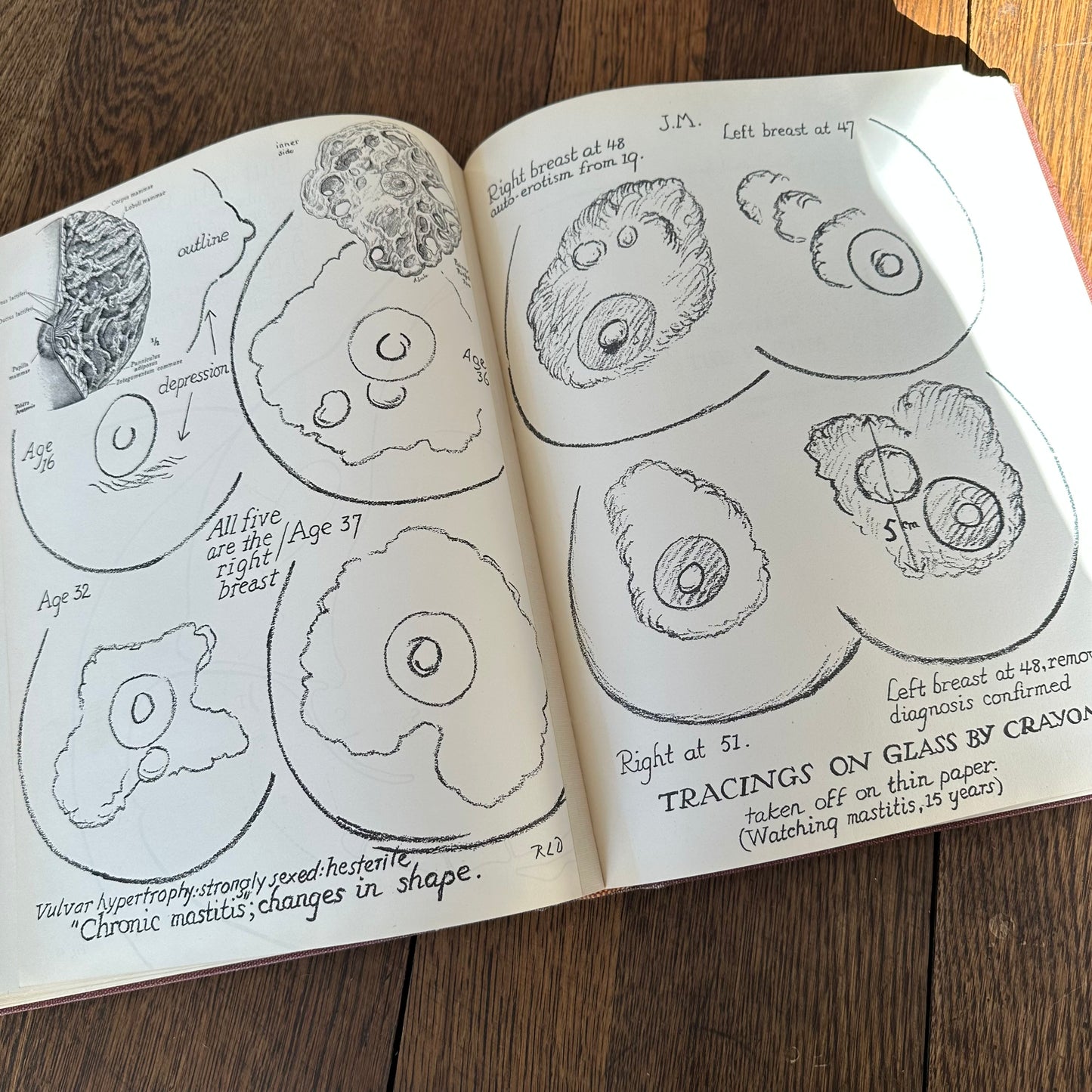 Human Sex Anatomy: A Topographical Hand Atlas, 1949
