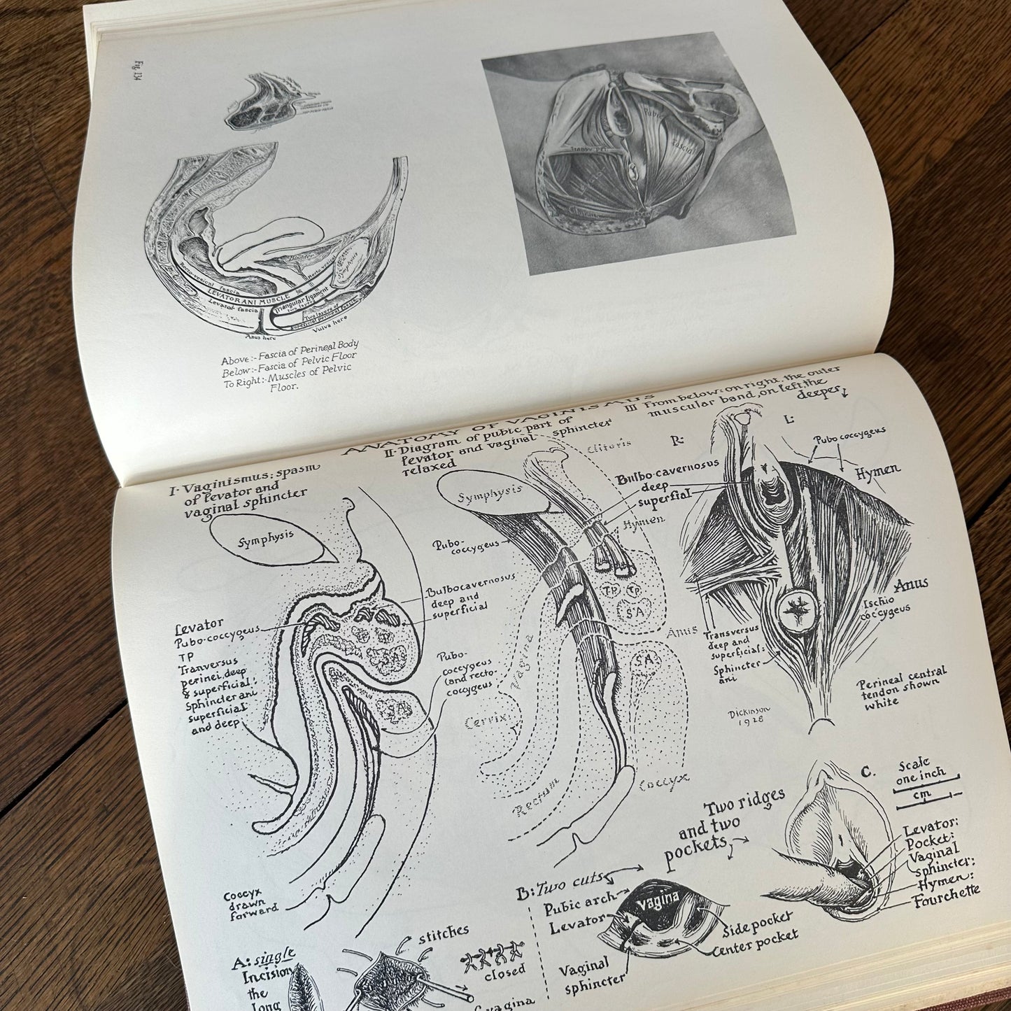 Human Sex Anatomy: A Topographical Hand Atlas, 1949