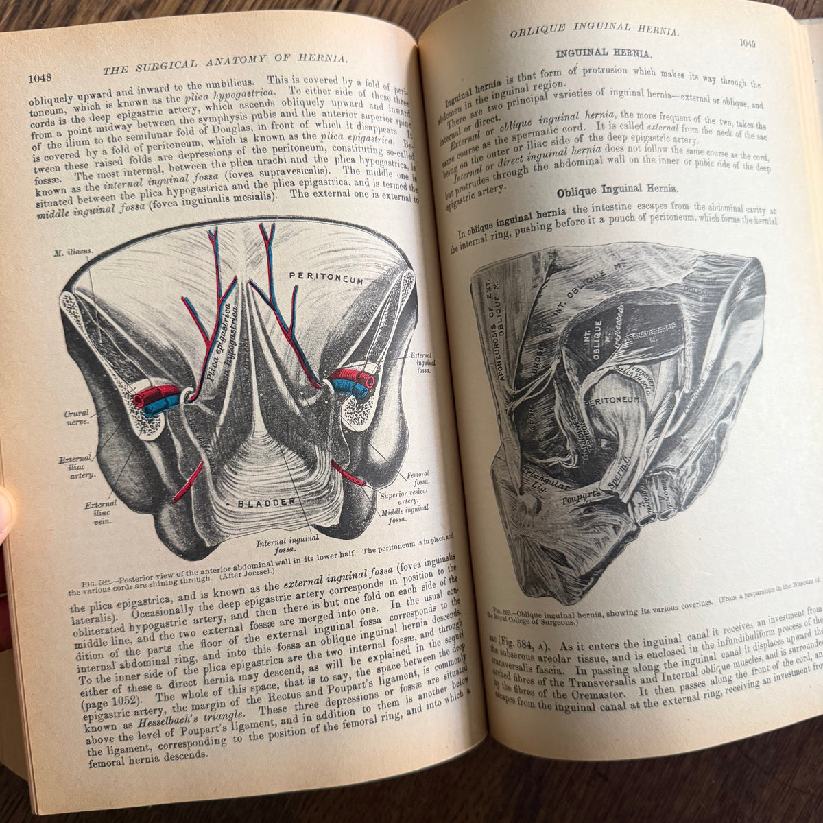 Gray’s Anatomy, 1977 Classic Collector’s Edition — Henry Gray, Descriptive & Surgical Anatomy | Bounty Books Hardcover, 780 Illustrations