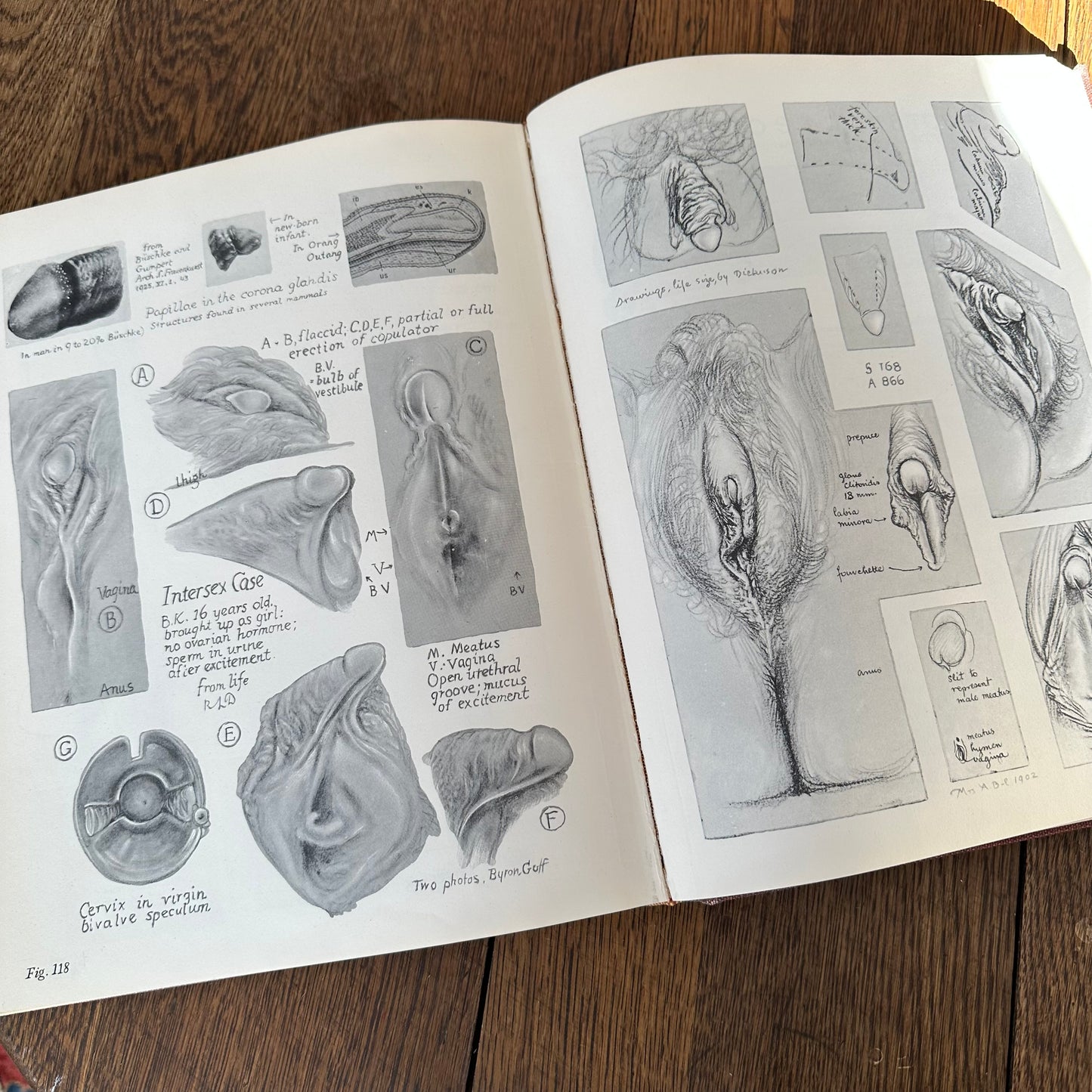Human Sex Anatomy: A Topographical Hand Atlas, 1949